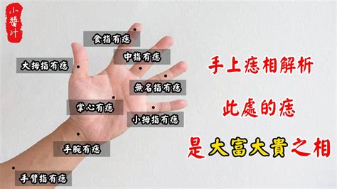 痣 手|你手上的痣長在哪裡？從手上的痣看運氣，財富、貴人。